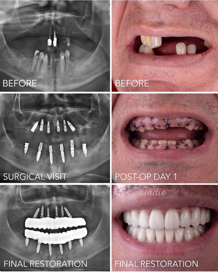 Sample Facebook post: Full restoration